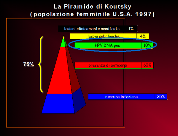 La Piramide di Koutsky